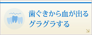 歯ぐきから血が出る、グラグラする