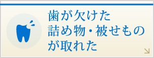 歯が欠けた、詰め物・被せものが取れた